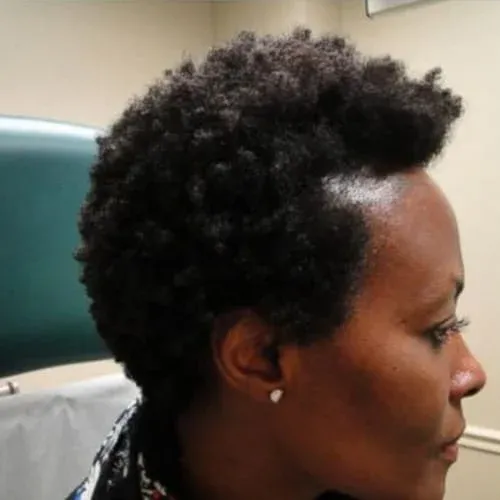 Profile of woman with short textured hair.