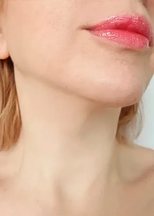 Close-up of lips and jawline with soft lighting.