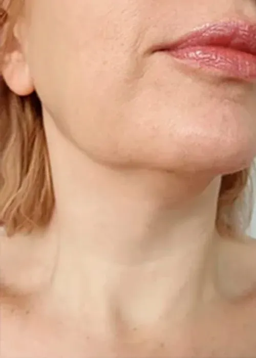 Close-up of woman's face and neck.