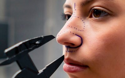 Rhinoplasty Treatment in Nairobi